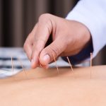 leistungen_akupuntur